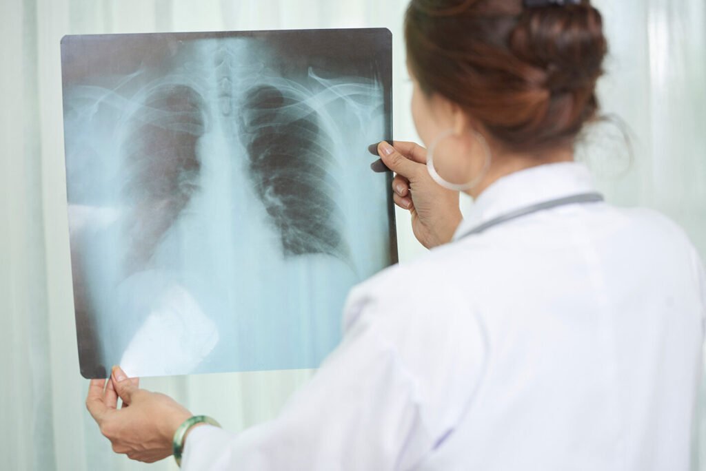 Radiografía de pulmones mostrada por doctora.