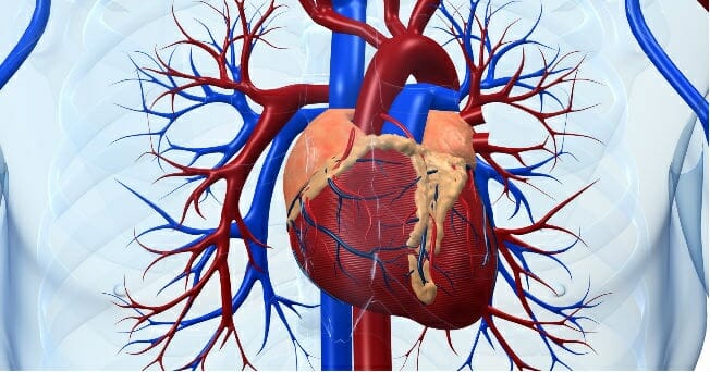 Ilustración que muestra el corazón y las arterias que lo rodean